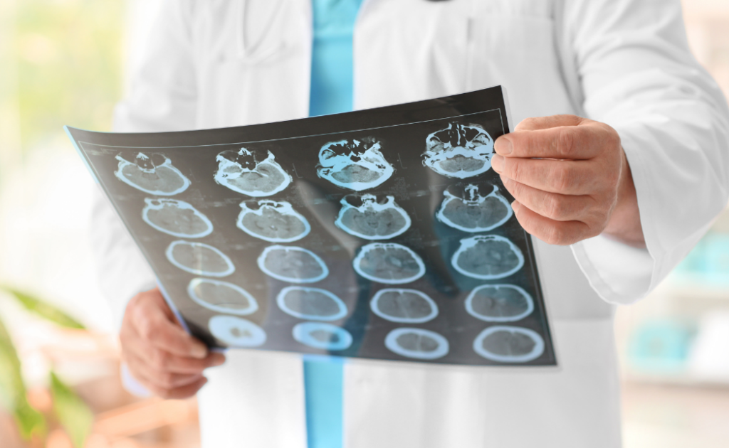 Medical professional in a white lab coat and light blue scrubs looking at a film of brain scans